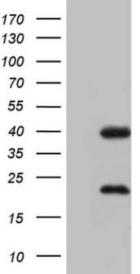 Western Blot: CAR/NR1I3 Antibody (OTI1C6) - Azide and BSA Free [NBP2-71525] - Analysis of HEK293T cells were transfected with the pCMV6-ENTRY control (Left lane) or pCMV6-ENTRY NR1I3.