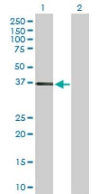 Western Blot: CAR/NR1I3 Antibody [H00009970-D01P] - Analysis of NR1I3 expression in transfected 293T cell line by NR1I3 polyclonal antibody.Lane 1: NR1I3 transfected lysate(39.90 KDa).Lane 2: Non-transfected lysate.