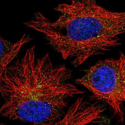 Immunocytochemistry/Immunofluorescence: CARD10 Antibody [NBP2-55720] - Staining of human cell line HeLa shows localization to vesicles.