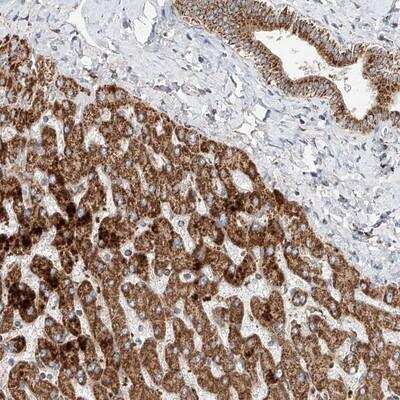 Immunohistochemistry-Paraffin: CARD10 Antibody [NBP1-88600] - Staining of human liver shows strong cytoplasmic positivity in hepatocytes.