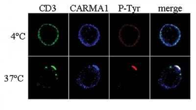 Immunocytochemistry/Immunofluorescence: CARD11/CARMA1 Antibody [NBP2-80110] - Analysis of CARMA1 using CARD11/CARMA1, pAb (AL220) (Prod. No. NBP2-80110).