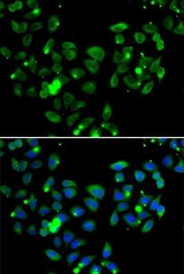 Immunocytochemistry/Immunofluorescence: CARD11/CARMA1 Antibody [NBP2-92910] - Immunofluorescence analysis of A549 cells using CARD11/CARMA1 antibody (NBP2-92910). Blue: DAPI for nuclear staining.