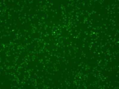 Immunocytochemistry/Immunofluorescence: CARD11/CARMA1 Antibody [NBP2-99265] - Immunofluorescence staining of CARD11/CARMA1 in mouse spleen cells. Cells were fixed with 4% PFA, blocked with 10% serum, and incubated with rabbit anti-Mouse CARD11/CARMA1 polyclonal antibody (dilution ratio 1:500) at 4C overnight. Then cells were stained with the Alexa Fluor(R)488-conjugated Goat Anti-rabbit IgG Secondary antibody (green). Positive staining was localized to Cell membrane and cytoplasm.