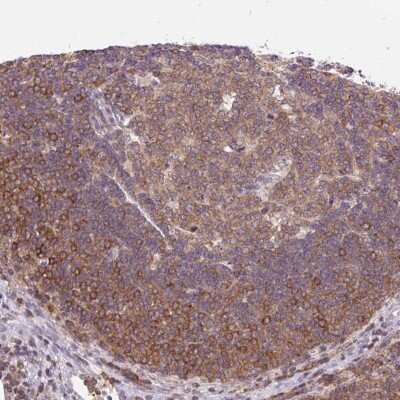 Immunohistochemistry: CARD11/CARMA1 Antibody [NBP2-49067] - Staining of human lymph node shows moderate cytoplasmic positivity in germinal and non-germinal center cells.