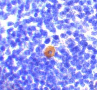 Immunohistochemistry-Paraffin: CARD11/CARMA1 Antibody [NBP1-77219] - Mouse thymus with CARD11 antibody at 10 ug/ml.