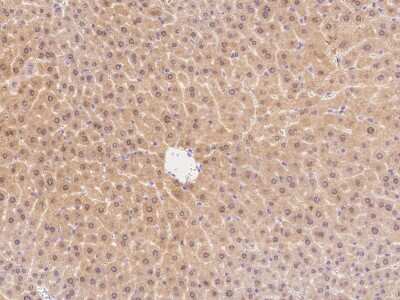 Immunohistochemistry-Paraffin: CARD11/CARMA1 Antibody [NBP2-99265] - Immunochemical staining of mouse CARD11/CARMA1 in mouse liver with rabbit polyclonal antibody at 1:300 dilution, formalin-fixed paraffin embedded sections.