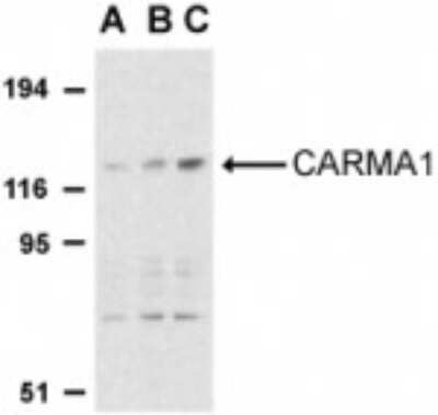 Western Blot: CARD11/CARMA1 Antibody [NBP1-77219] - Western blot analysis of CARD11 expression in mouse thymus cell lysate with anti-CARMA1 using antibody at 0.5 (lane A), 1 (lane B), and 2 ug /ml (lane C), respectively.