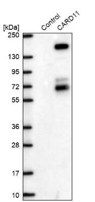 Western Blot: CARD11/CARMA1 Antibody [NBP2-49067] - Analysis in control (vector only transfected HEK293T lysate) and CARD11 over-expression lysate (Co-expressed with a C-terminal myc-DDK tag (3.1 kDa) in mammalian HEK293T cells).