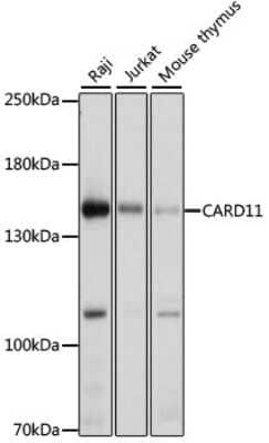 Western Blot: CARD11/CARMA1 Antibody [NBP2-92910] - Analysis of extracts of various cell lines, using CARD11/CARMA1 at 1:1000 dilution.Secondary antibody: HRP Goat Anti-Rabbit IgG (H+L) at 1:10000 dilution.Lysates/proteins: 25ug per lane.Blocking buffer: 3% nonfat dry milk in TBST.Detection: ECL Basic Kit .Exposure time: 10s.