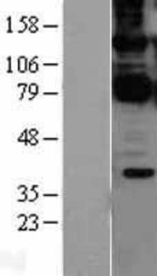 Western Blot CARD11/CARMA1 Overexpression Lysate