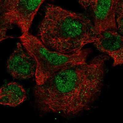 Immunocytochemistry/Immunofluorescence: CARD8 Antibody [NBP2-47528] - Immunofluorescent staining of human cell line A549 shows localization to nucleoplasm.