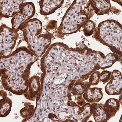 Immunohistochemistry-Paraffin: CARD8 Antibody [NBP2-47527] - Staining of human placenta tissue. Shows strong cytoplasmic and nuclear positivity in trophoblastic cells.