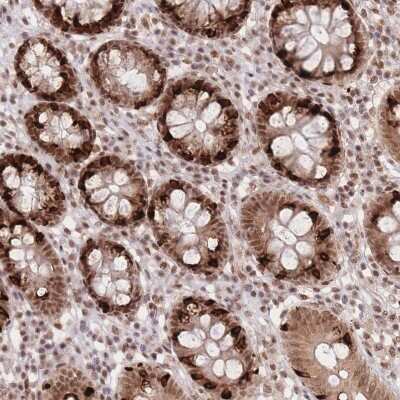 Immunohistochemistry-Paraffin: CARD8 Antibody [NBP2-47528] - Staining of human colon tissue. Shows strong nuclear and cytoplasmic positivity in glandular cells.