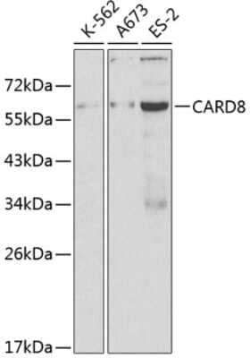 Western Blot: CARD8 Antibody [NBP2-91989] - Analysis of extracts of various cell lines, using CARD8 at 1:1000 dilution.Secondary antibody: HRP Goat Anti-Rabbit IgG (H+L) at 1:10000 dilution.Lysates/proteins: 25ug per lane.Blocking buffer: 3% nonfat dry milk in TBST.