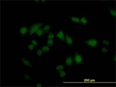 Immunocytochemistry/Immunofluorescence: CARF/CDKN2AIP Antibody (1A6) [H00055602-M02] - Analysis of monoclonal antibody to CARF on HeLa cell. Antibody concentration 10 ug/ml.