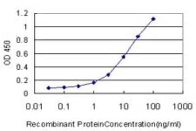 Sandwich ELISA: CARF/CDKN2AIP Antibody (1A6) [H00055602-M02] - Detection limit for recombinant GST tagged CARF is approximately 1ng/ml as a capture antibody.