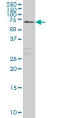 Western Blot: CARF/CDKN2AIP Antibody (1E10) [H00055602-M03] - Analysis of CARF expression in Hela S3 NE (Cat # L013V3).