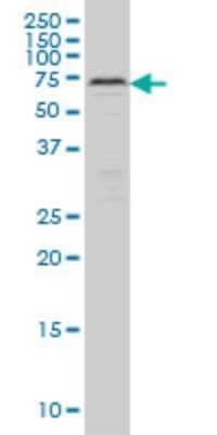 Western Blot: CARF/CDKN2AIP Antibody (2E6) [H00055602-M04] - Analysis of CARF expression in Hela S3 NE (Cat # L013V3).