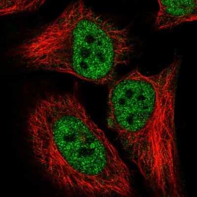 Immunocytochemistry/Immunofluorescence: CARF/CDKN2AIP Antibody [NBP2-55694] - Staining of human cell line HeLa shows localization to nucleoplasm.