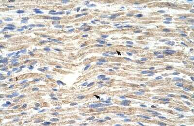 Immunohistochemistry-Paraffin: CARF/CDKN2AIP Antibody [NBP1-57236] - Human Muscle Tissue, Skeletal muscle cells (Indicated with Arrows) 4-8ug/ml.
