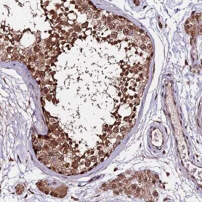 Immunohistochemistry-Paraffin CARF/CDKN2AIP Antibody - BSA Free
