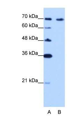 Western Blot: CARF/CDKN2AIP Antibody [NBP1-57236] - Jurkat cell lysate, Antibody Titration: 0.3125ug/ml