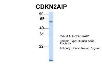 Western Blot: CARF/CDKN2AIP Antibody [NBP1-57555] - Human Adult Placenta, Antibody Dilution: 1.0 ug/ml.