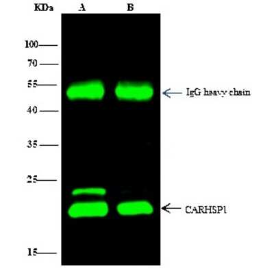 Immunoprecipitation: CARHSP1 Antibody [NBP3-00026] - CARHSP1 was immunoprecipitated using: Lane A: 0.5 mg HepG2 Whole Cell Lysate. Lane B: 0.5 mg 293T Whole Cell Lysate 2 ul anti-CARHSP1 rabbit polyclonal antibody and 15 ul of 50 % Protein G agarose. Primary antibody: Anti-CARHSP1 rabbit polyclonal antibody, at 1:200 dilution. Secondary antibody: Dylight 800-labeled antibody to rabbit IgG (H+L), at 1:5000 dilution. Developed using the Odyssey technique. Performed under reducing conditions. Predicted band size: 22 kDa. Observed band size: 22 kDa