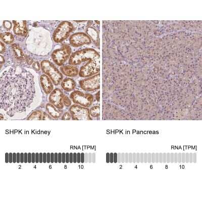 <b>Orthogonal Strategies Validation. </b>Immunohistochemistry-Paraffin: CARKL Antibody [NBP2-49429] - Staining in human kidney and pancreas tissues using anti-SHPK antibody. Corresponding SHPK RNA-seq data are presented for the same tissues.