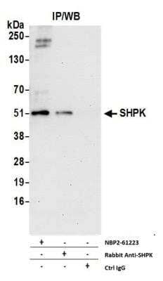 Immunoprecipitation: CARKL Antibody [NBP2-61223] - Detection of Human SHPK by Western Blot of Immunoprecipitates. Samples: Whole cell lysate (1.0 mg per IP reaction; 20% of IP loaded) from 293T cells prepared using NETN lysis buffer. Antibodies: Affinity purified rabbit anti-SHPK antibody NBP2-61223 used for IP at 8 ul per reaction. SHPK was also immunoprecipitated by rabbit anti-SHPK antibody. For blotting immunoprecipitated SHPK, NBP2-61223 was used at 1:400. Detection: Chemiluminescence with an exposure time of 3 minutes.
