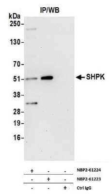 Immunoprecipitation: CARKL Antibody [NBP2-61224] - Detection of Human SHPK by Western Blot of Immunoprecipitates. Samples: Whole cell lysate (1.0 mg per IP reaction; 20% of IP loaded) from 293T cells prepared using NETN lysis buffer. Antibodies: Affinity purified rabbit anti-SHPK antibody NBP2-61224 used for IP at 20 ul per reaction. SHPK was also immunoprecipitated by rabbit anti-SHPK antibody NBP2-61223. For blotting immunoprecipitated SHPK, NBP2-61224 was used at 1:100. Detection: Chemiluminescence with an exposure time of 3 minutes.