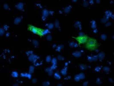 Immunocytochemistry/Immunofluorescence: CARKL Antibody (OTI3D7) - Azide and BSA Free [NBP2-71771] - Staining of COS7 cells transiently transfected by pCMV6-ENTRY CARKL.