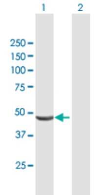 Western Blot: CARKL Antibody [H00023729-B01P] - Analysis of SHPK expression in transfected 293T cell line by SHPK polyclonal antibody.  Lane 1: CARKL transfected lysate(52.58 KDa). Lane 2: Non-transfected lysate.