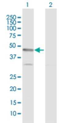 Western Blot: CARKL Antibody [H00023729-D01P] - Analysis of CARKL expression in transfected 293T cell line by CARKL polyclonal antibody.Lane 1: CARKL transfected lysate(51.50 KDa).Lane 2: Non-transfected lysate.