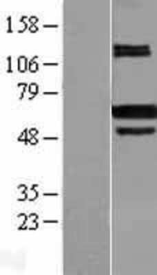 Western Blot: CARM1 Overexpression Lysate (Adult Normal) [NBL1-08698] Left-Empty vector transfected control cell lysate (HEK293 cell lysate); Right -Over-expression Lysate for CARM1.