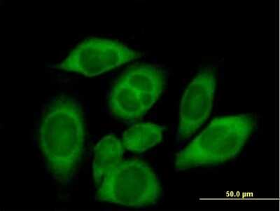 Immunocytochemistry/Immunofluorescence: CARS Antibody [H00000833-B01P] - Analysis of purified antibody to CARS on HeLa cell. (antibody concentration 7 ug/ml)