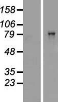 Western Blot CARS Overexpression Lysate