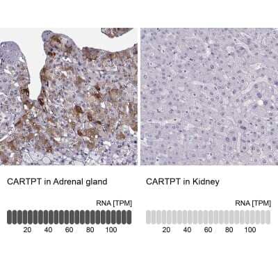 Immunohistochemistry-Paraffin: CART/CARTPT Antibody [NBP1-91749] - Analysis in human adrenal gland and kidney tissues using NBP1-91749 antibody. Corresponding CARTPT RNA-seq data are presented for the same tissues.