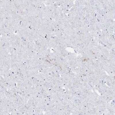 Immunohistochemistry-Paraffin: CART/CARTPT Antibody [NBP1-91749] - Staining of human hypothalamus shows moderate positivity in neuronal cell projections.