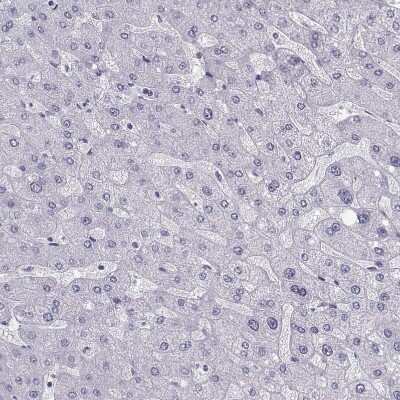 Immunohistochemistry-Paraffin: CART/CARTPT Antibody [NBP1-91749] - Staining of human liver shows no cytoplasmic positivity in hepatocytes as expected.