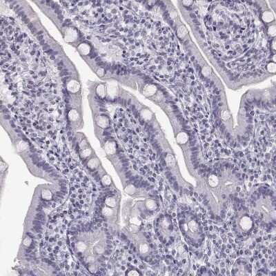 Immunohistochemistry-Paraffin: CART/CARTPT Antibody [NBP1-91749] - Staining of human small intestine shows no cytoplasmic positivity in glandular cells as expected.