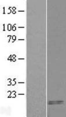 Western Blot: CARTPT Overexpression Lysate (Adult Normal) [NBL1-08700] Left-Empty vector transfected control cell lysate (HEK293 cell lysate); Right -Over-expression Lysate for CARTPT.