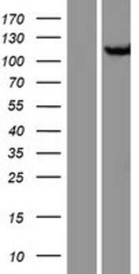 Western Blot: CAS/Exportin-2 Overexpression Lysate (Adult Normal) [NBP2-10972] Left-Empty vector transfected control cell lysate (HEK293 cell lysate); Right -Over-expression Lysate for CAS/Exportin-2.