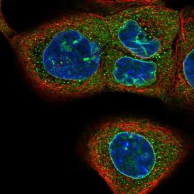 Immunocytochemistry/Immunofluorescence: CASC3 Antibody [NBP2-55636] - Staining of human cell line A-431 shows localization to nuclear membrane.