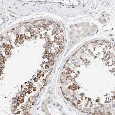 Immunohistochemistry-Paraffin: CASC3 Antibody [NBP1-88515] - Staining of human testis shows strong cytoplasmic positivity in seminiferous ducts.