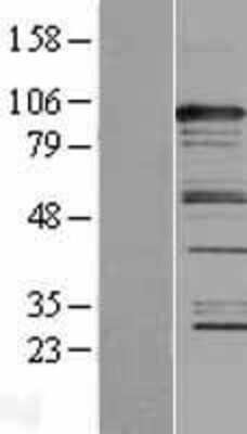 Western Blot CASC3 Overexpression Lysate