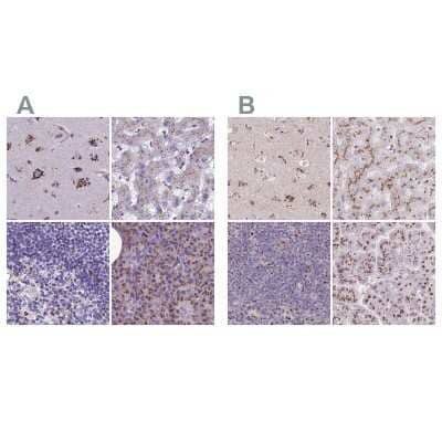 Immunohistochemistry-Paraffin CASC4 Antibody - BSA Free