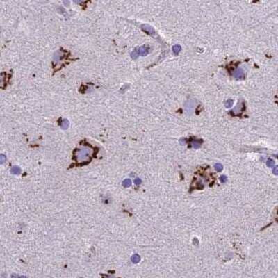 Immunohistochemistry-Paraffin CASC4 Antibody - BSA Free