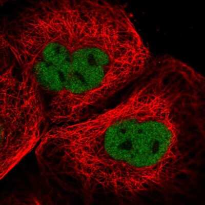 Immunocytochemistry/Immunofluorescence: CASC5 Antibody [NBP1-89223] - Immunofluorescent staining of human cell line A-431 shows localization to nucleoplasm.