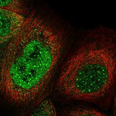 Immunocytochemistry/Immunofluorescence: CASC5 Antibody [NBP2-56821] - Staining of human cell line A-431 shows localization to nucleoplasm, nuclear bodies & cytosol.